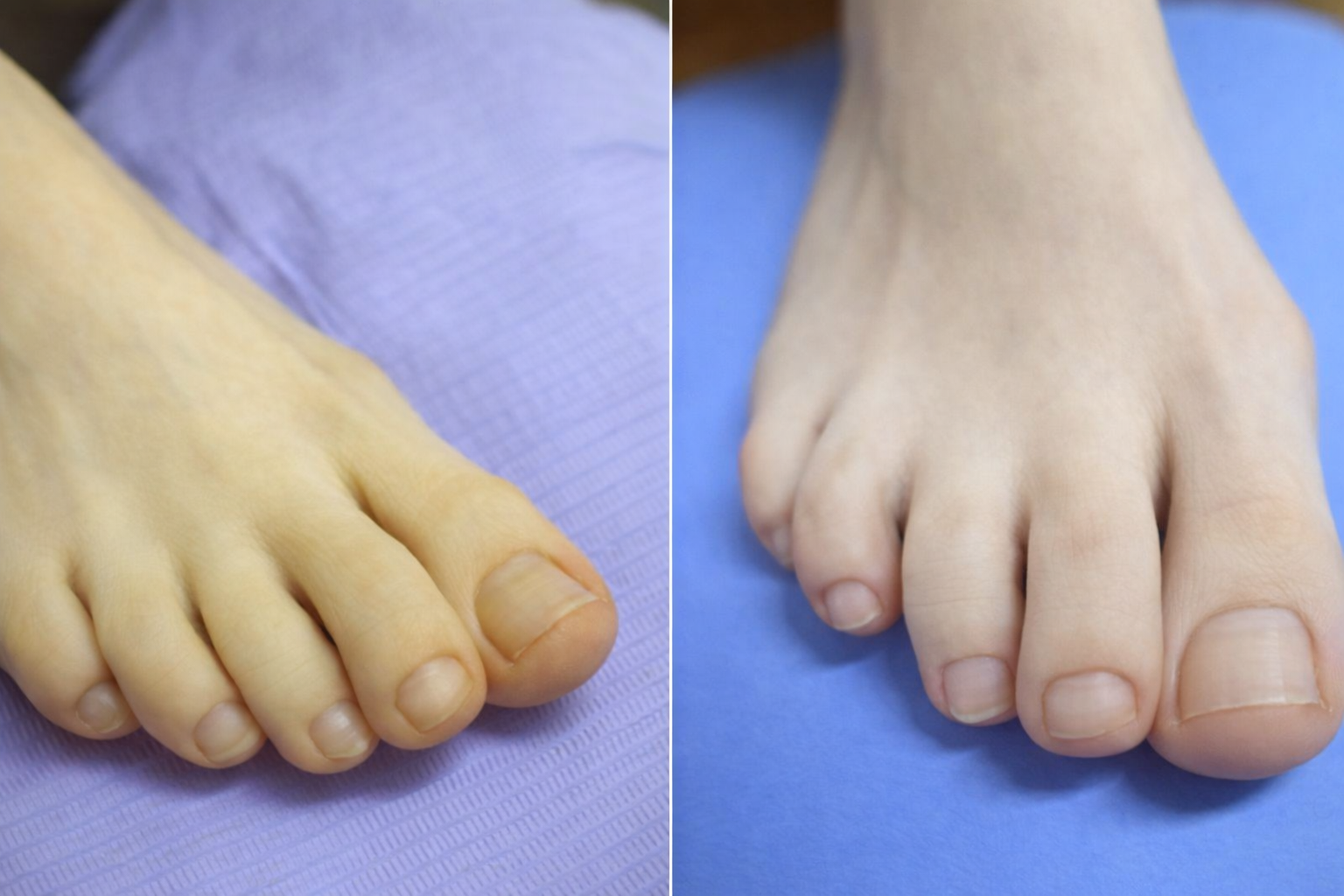 Pedicure higieniczny